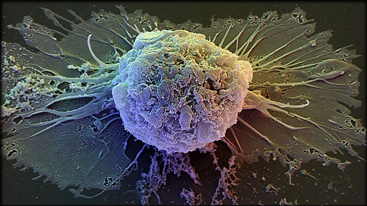 A human embryonic stem cell resting on a fibroblast cell. David Scharf / Science Faction / Corbis